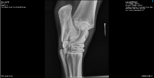 Right Tarsus Hock Lateral Oblique